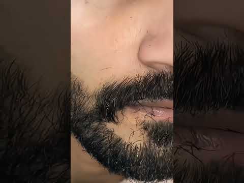 https://youtube.com/shorts/ic0MH0Z0B5k?si=F824OUWxnau3rYfR